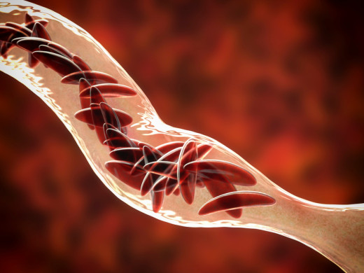 Jak řešit sezónní variabilitu krevního tlaku