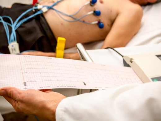 Má oportunní screening fibrilace síní význam?