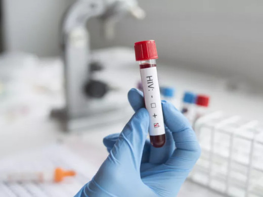 ČLK: Lékař musí vědět, že pacient je HIV pozitivní