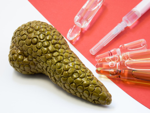 Hypertriglyceridemií indukovaná akutní pankreatitida