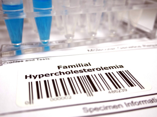 Jaké je kardiovaskulární riziko pacientů s familiární hypercholesterolemií?