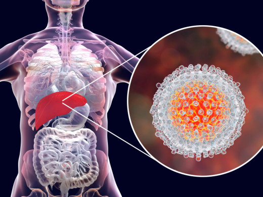 Terapie chronické hepatitidy C v roce 2020