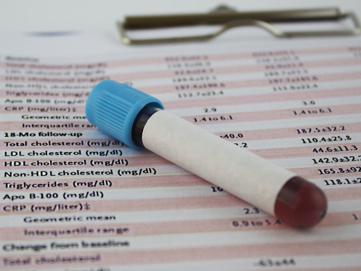 Hypocholesterolemie v intenzivní péči