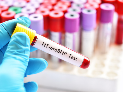 Čeští kardiologové rukují do bitvy za zdravé srdce