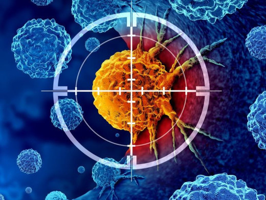 Dva ze tří oslovených klientů VZP ČR se zapojují do screeningu rakoviny plic, odhaleny byly víc než dvě stovky nádorů