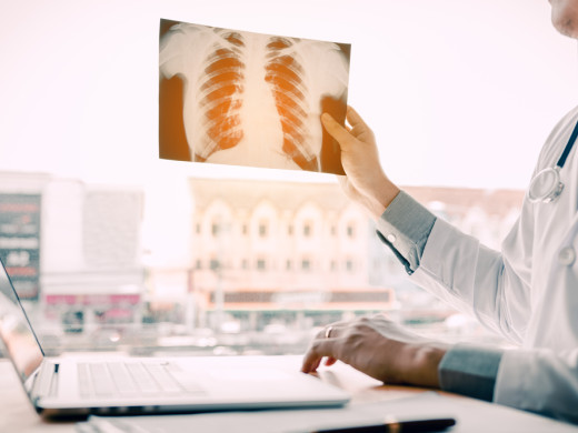 Lékaři ve VFN provedli novou operační metodu plic