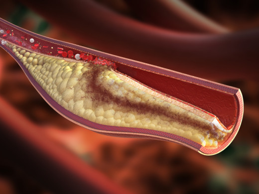 Cévní věk: ověřený nástroj pro zlepšení adherence
