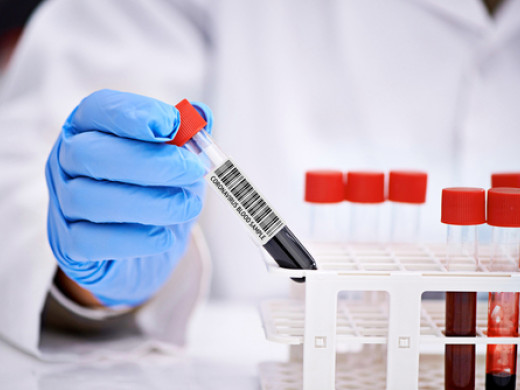 Role praktických lékařů ve zvládání epidemie COVID-19