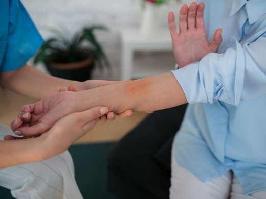 Atopický ekzém v nejtěžší formě lze léčit biologickou léčbou