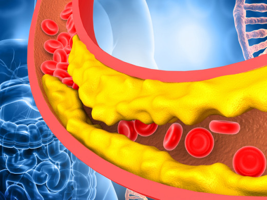 Vrablík: Nečekejme na zázrak a postavme se LDL cholesterolu hned