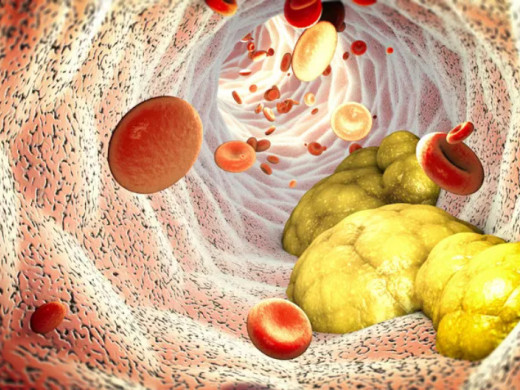 Svůj cholesterol zná jen 28 procent lidí