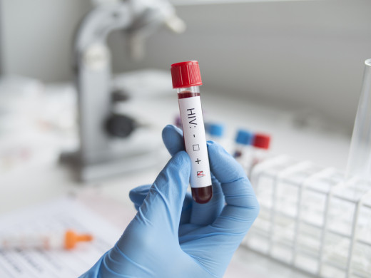 Počet pacientů s HIV roste, VZP loni hradila léčbu pro 3 000 lidí